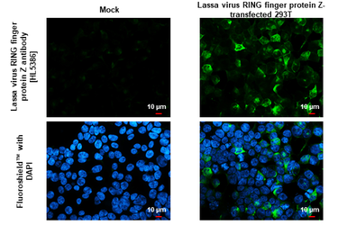 Anti-Lassa virus RING finger protein Z antibody [HL5386] used in Immunocytochemistry/ Immunofluorescence (ICC/IF). GTX645954
